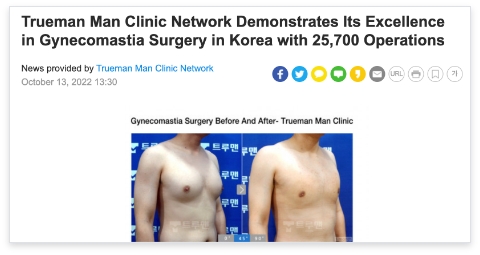 gynecomastia surgery